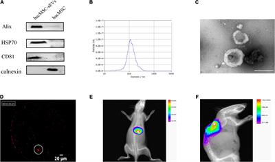 Small extracellular vesicles derived from mesenchymal stem cell facilitate functional recovery in spinal cord injury by activating neural stem cells via the ERK1/2 pathway